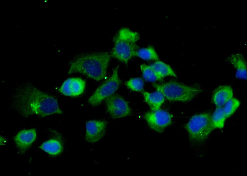 Immunofluorescent analysis of (-20oc Ethanol) fixed A431 cells using Catalog No:108846(CAPZB Antibody) at dilution of 1:25 and Alexa Fluor 488-congugated AffiniPure Goat Anti-Rabbit IgG(H+L)