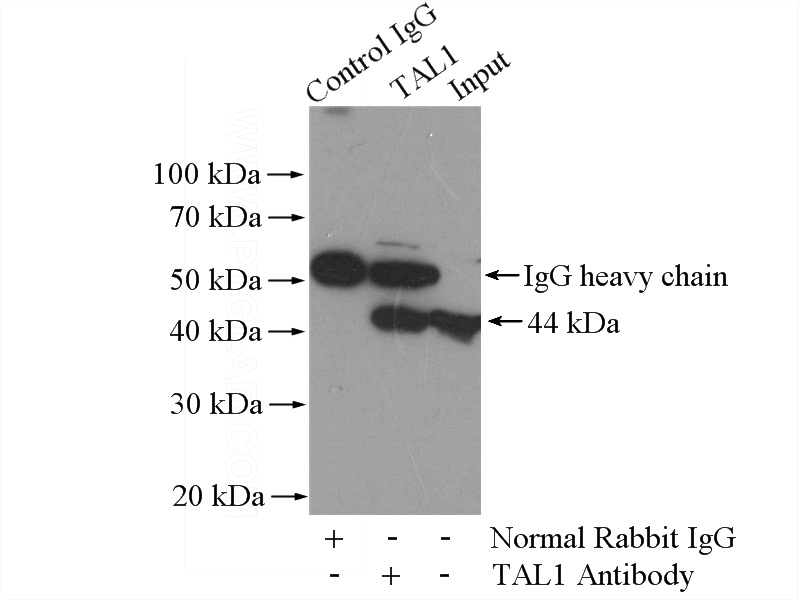 IP Result of anti-TAL1 (IP:Catalog No:115843, 4ug; Detection:Catalog No:115843 1:1000) with Raji cells lysate 2000ug.