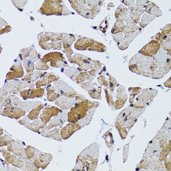 Immunohistochemistry - MRPS6 Polyclonal Antibody 