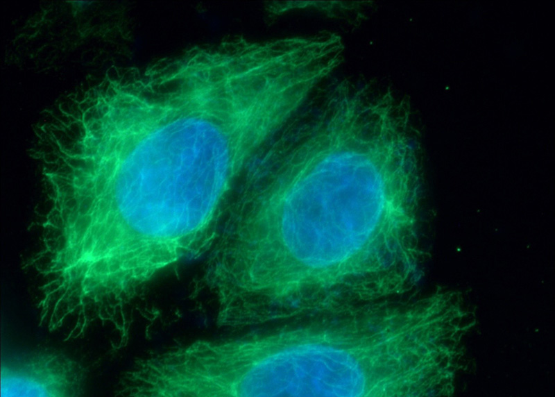 Immunofluorescent analysis of HeLa cells using Catalog No:107018(BID Antibody) at dilution of 1:50 and Alexa Fluor 488-congugated AffiniPure Goat Anti-Mouse IgG(H+L)