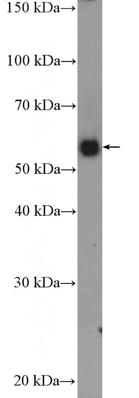 mouse liver tissue were subjected to SDS PAGE followed by western blot with Catalog No:115209(SERPING1 Antibody) at dilution of 1:1000