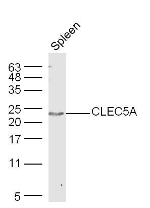 Fig2: Sample: Spleen (Mouse) Lysate at 40 ug; Primary: Anti-CLEC5A at 1/300 dilution; Secondary: IRDye800CW Goat Anti-Rabbit IgG at 1/20000 dilution; Predicted band size: 22 kD; Observed band size: 22 kD