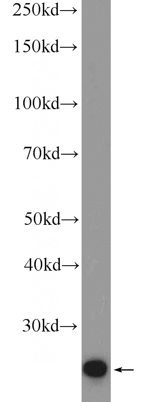HEK-293 cells were subjected to SDS PAGE followed by western blot with Catalog No:116037(THAP1 Antibody) at dilution of 1:1000
