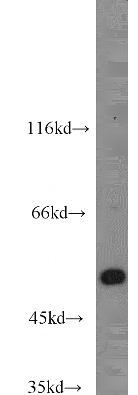 RAW264.7 cells were subjected to SDS PAGE followed by western blot with Catalog No:117126(Beta Arrestin 2 antibody) at dilution of 1:2000