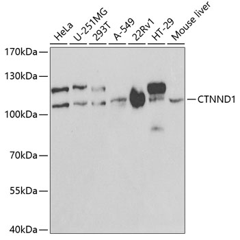 Western blot - CTNND1 Polyclonal Antibody 