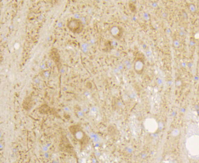 Immunohistochemistry - GRM5 Monoclonal Antibody 