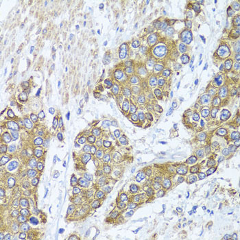 Immunohistochemistry - PEX14 Polyclonal Antibody 