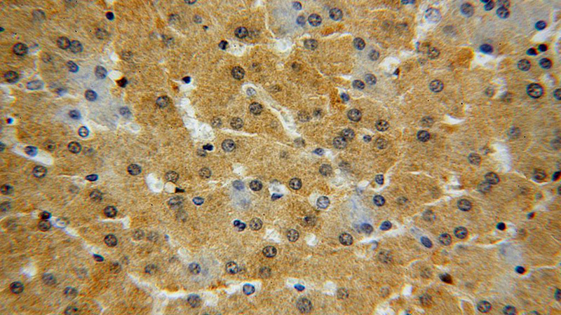 Immunohistochemical of paraffin-embedded human liver using Catalog No:110853(GALT antibody) at dilution of 1:100 (under 40x lens)