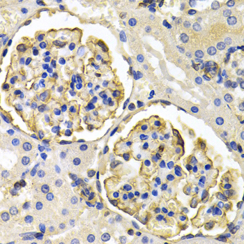Immunohistochemistry - KLKB1 Polyclonal Antibody 