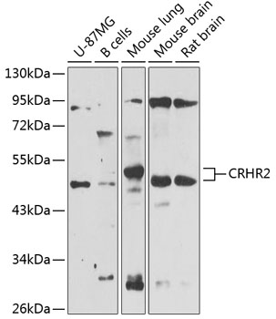 Western blot - CRHR2 Polyclonal Antibody 