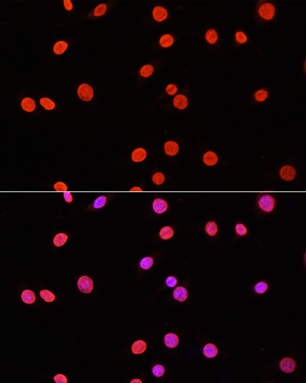 Immunofluorescence - DiMethyl-DNMT3A-K44 pAb 