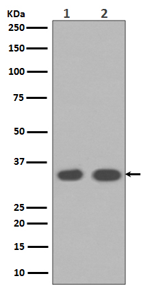 Western blot analysis of Cyclin D1 expression in (1)MCF-7 cell lysates;(2) LnCaP cell lysates.