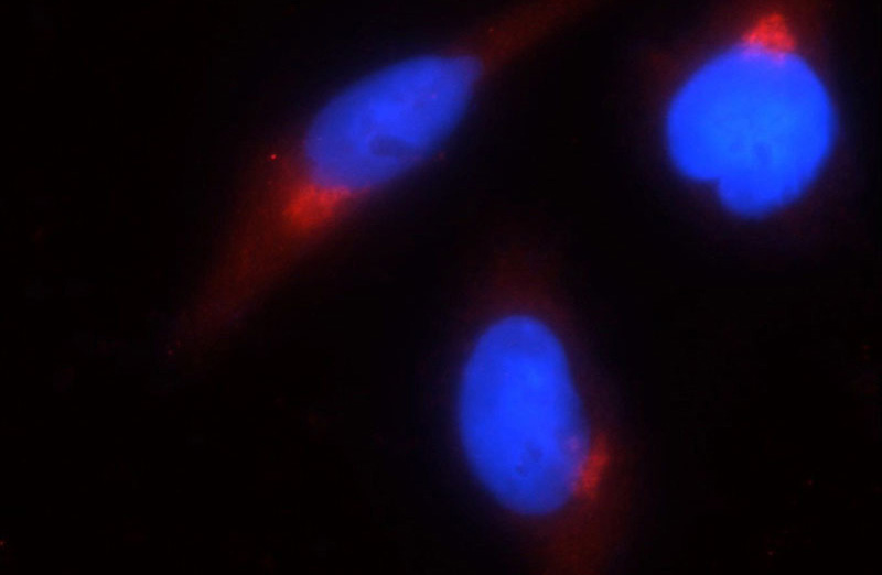Immunofluorescent analysis of HepG2 cells using Catalog No:111045(GOLPH3 Antibody) at dilution of 1:25 and Rhodamine-Goat anti-Rabbit IgG