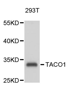 Western blot - TACO1 Polyclonal Antibody 