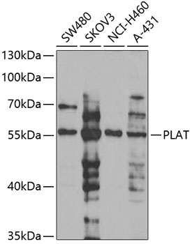Western blot - PLAT Polyclonal Antibody 