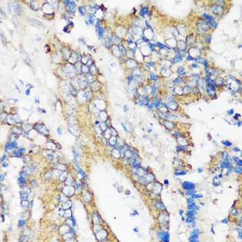 Immunohistochemistry - ELP3 Polyclonal Antibody 