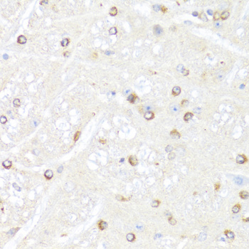 Immunohistochemistry - POLR2B Polyclonal Antibody 