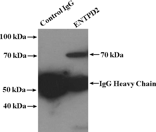 IP Result of anti-ENTPD2 (IP:Catalog No:110331, 4ug; Detection:Catalog No:110331 1:300) with K-562 cells lysate 4000ug.