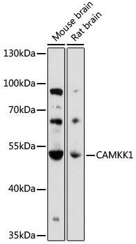 Western blot - CAMKK1 Polyclonal Antibody 