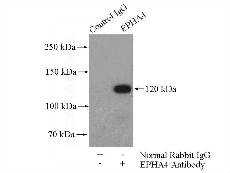 IP Result of anti-EPHA4 (IP:Catalog No:110349, 4ug; Detection:Catalog No:110349 1:1000) with mouse brain tissue lysate 4000ug.