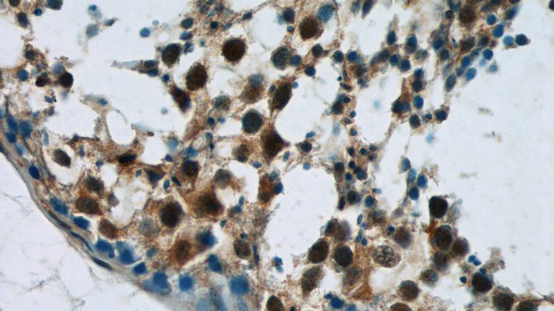 Immunohistochemistry of paraffin-embedded human testis tissue slide using Catalog No:110591(FAM48A Antibody) at dilution of 1:50 (under 40x lens)