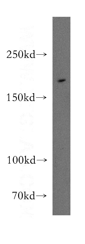 mouse lung tissue were subjected to SDS PAGE followed by western blot with Catalog No:110248(ENG antibody) at dilution of 1:300