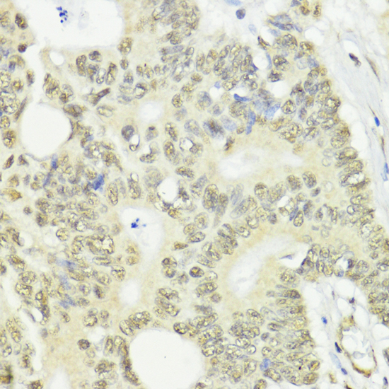Immunohistochemistry - CTCF Polyclonal Antibody 