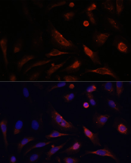 Immunofluorescence - CLDN5 Polyclonal Antibody 