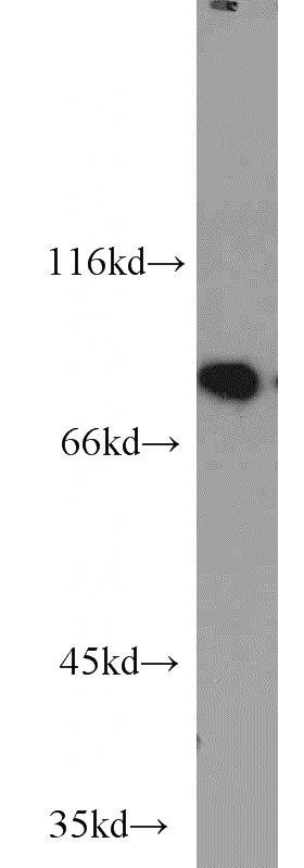 HEK-293 cells were subjected to SDS PAGE followed by western blot with Catalog No:113034(CBP80 antibody) at dilution of 1:1000