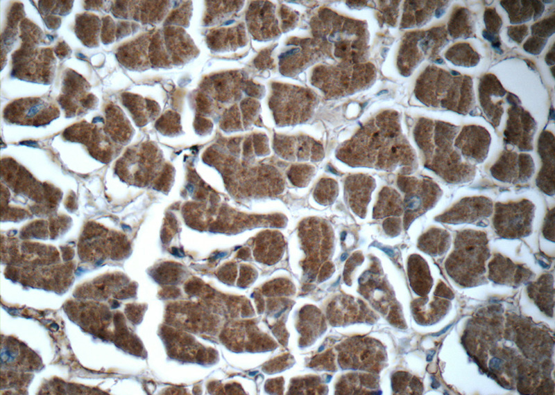 Immunohistochemistry of paraffin-embedded human heart tissue slide using Catalog No:112103(KLHL31 Antibody) at dilution of 1:50 (under 40x lens)