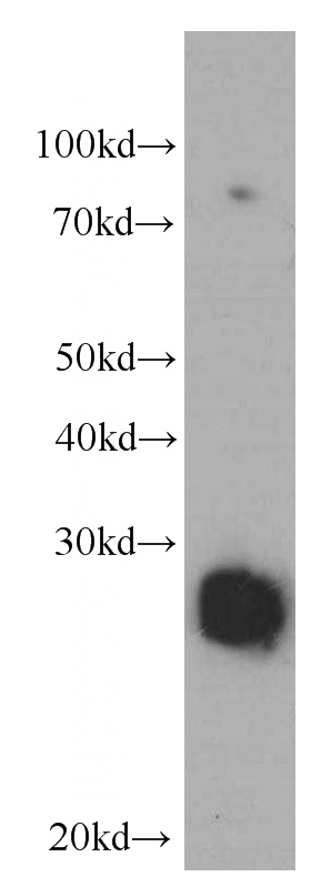 HepG2 cells were subjected to SDS PAGE followed by western blot with Catalog No:107536(VAPB Antibody) at dilution of 1:1000