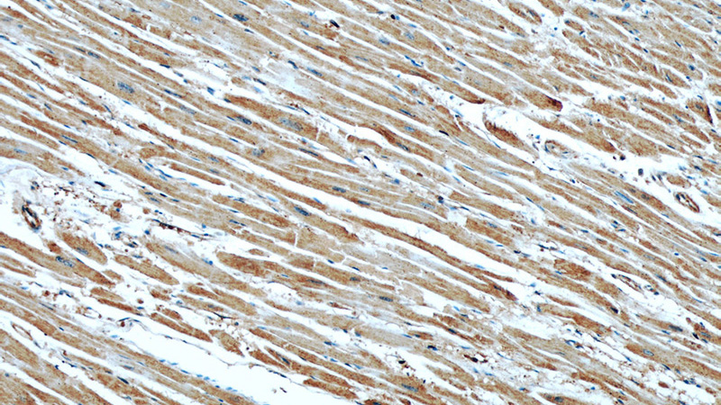 Immunohistochemical of paraffin-embedded human heart using Catalog No:107293(GEFT antibody) at dilution of 1:50 (under 10x lens)