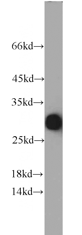 human kidney tissue were subjected to SDS PAGE followed by western blot with Catalog No:115212(APCS antibody) at dilution of 1:1000