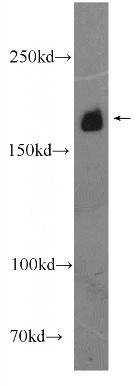 mouse brain tissue were subjected to SDS PAGE followed by western blot with Catalog No:112272(LAMC3-Specific Antibody) at dilution of 1:600