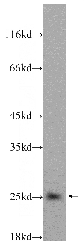 Tunicamycin treated HeLa cells were subjected to SDS PAGE followed by western blot with Catalog No:108404(BAD Antibody) at dilution of 1:300