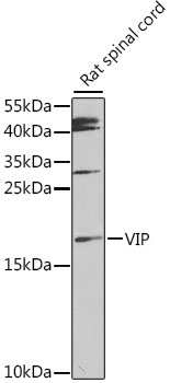 Western blot - VIP Polyclonal Antibody 
