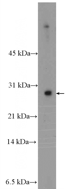 MCF-7 cells were subjected to SDS PAGE followed by western blot with Catalog No:112925(MYEOV2 Antibody) at dilution of 1:300
