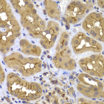 Immunohistochemistry - FASTK Polyclonal Antibody 