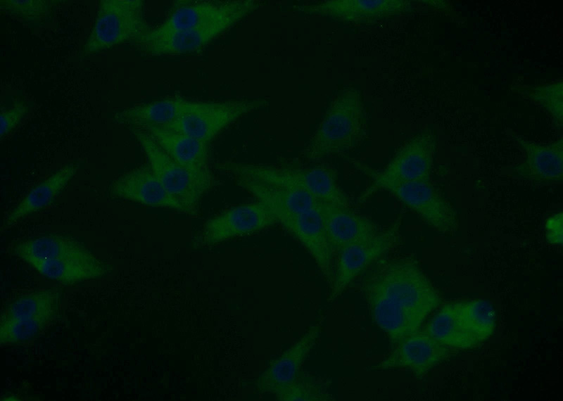 Immunofluorescent analysis of A375 cells using Catalog No:110136(DYNC1I2 Antibody) at dilution of 1:25 and Alexa Fluor 488-congugated AffiniPure Goat Anti-Rabbit IgG(H+L)
