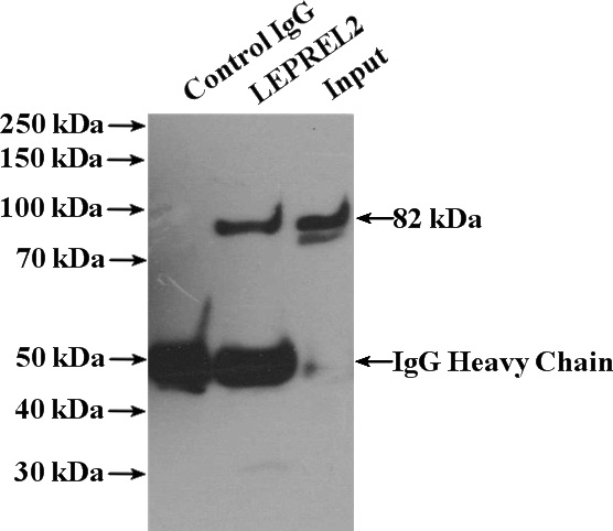 IP Result of anti-LEPREL2 (IP:Catalog No:112199, 4ug; Detection:Catalog No:112199 1:500) with MDA-MB-453s cells lysate 2800ug.