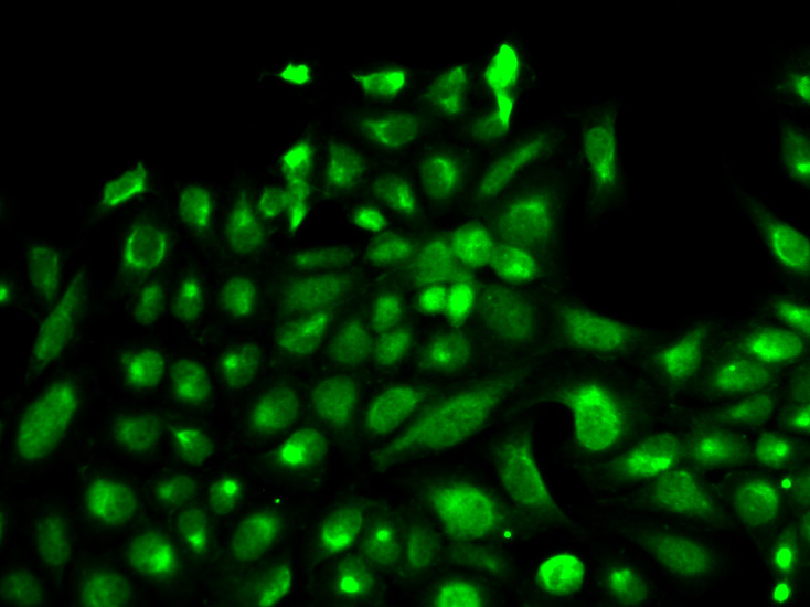 Immunofluorescence - SPHK1 Polyclonal Antibody 
