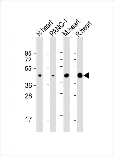 All lanes: Anti-WNT5A Antibody (Center) at 1:2000 dilution Lane 1: human heart lysate Lane 2: PANC-1 whole cell lysate Lane 3: mouse heart lysate Lane 4: rat heart lysate Lysates/proteins at 20 μg per lane. Secondary Goat Anti-Rabbit IgG, (H+L), Peroxidase conjugated at 1/10000 dilution. Predicted band size: 42 kDa Blocking/Dilution buffer: 5% NFDM/TBST.