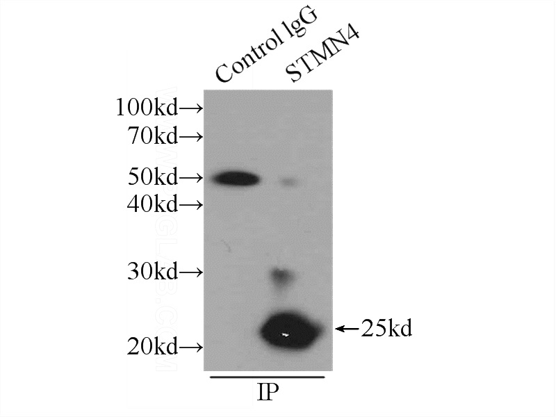 IP Result of anti-STMN4 (IP:Catalog No:115728, 3ug; Detection:Catalog No:115728 1:1000) with mouse brain tissue lysate 6000ug.