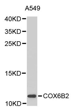 Western blot - COX6B2 Polyclonal Antibody 
