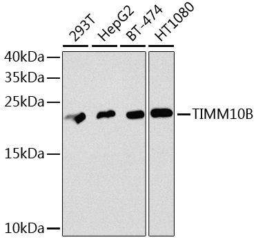 Western blot - TIMM10B Polyclonal Antibody 