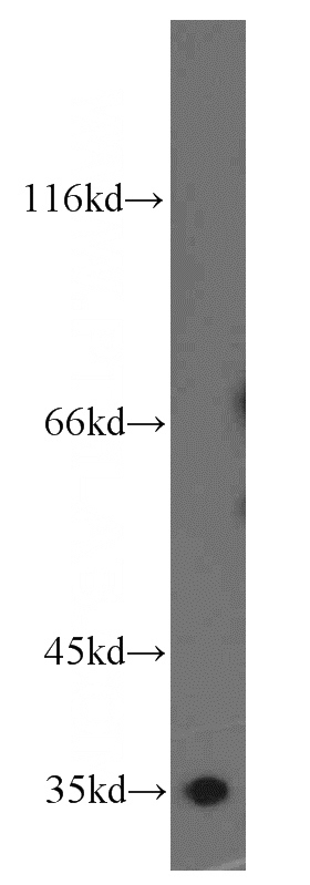 PC-3 cells were subjected to SDS PAGE followed by western blot with Catalog No:109457(COPE antibody) at dilution of 1:500