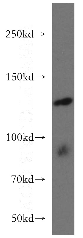 mouse testis tissue were subjected to SDS PAGE followed by western blot with Catalog No:108185(ARHGEF18 antibody) at dilution of 1:300