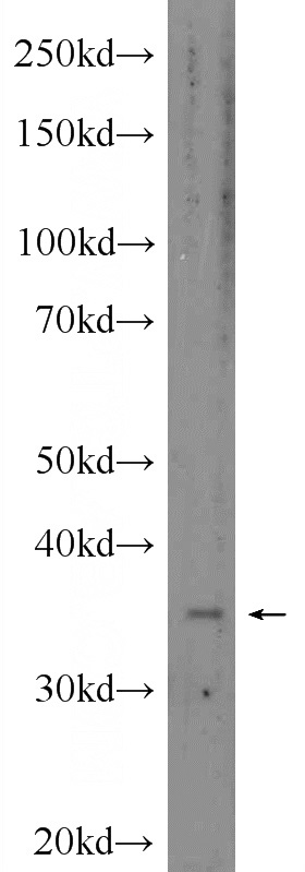 HepG2 cells were subjected to SDS PAGE followed by western blot with Catalog No:110691(FOXB1 Antibody) at dilution of 1:300