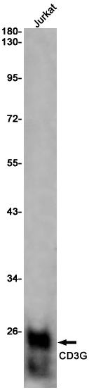 Western blot detection of CD3G in Jurkat cell lysates using CD3G Rabbit pAb(1:1000 diluted).Predicted band size:21KDa.Observed band size:21KDa.