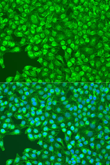 Immunofluorescence - SYK Polyclonal Antibody 